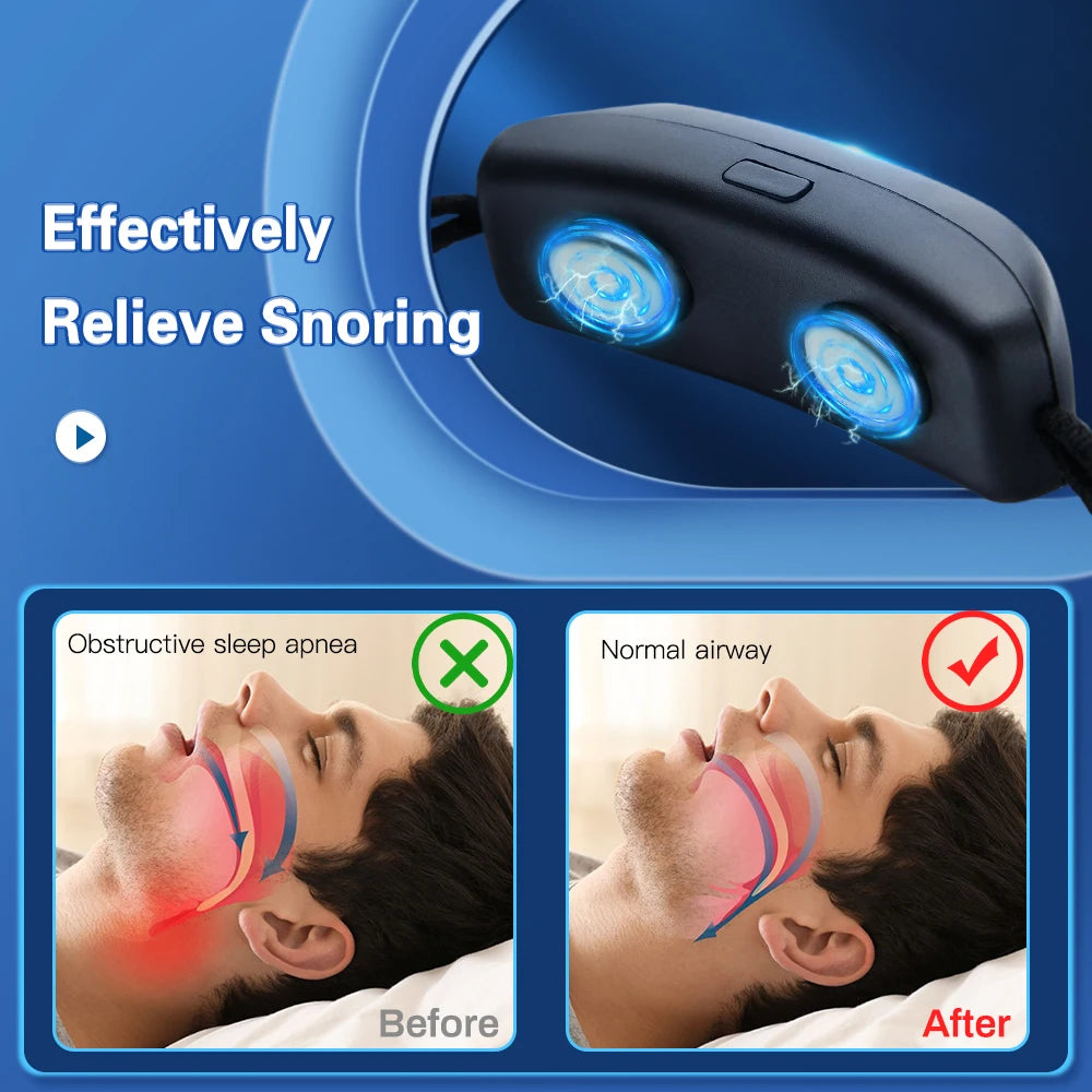 CAMMUO Smart Anti-Snoring Device