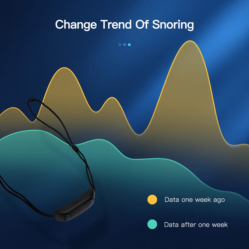 CAMMUO Smart Anti-Snoring Device