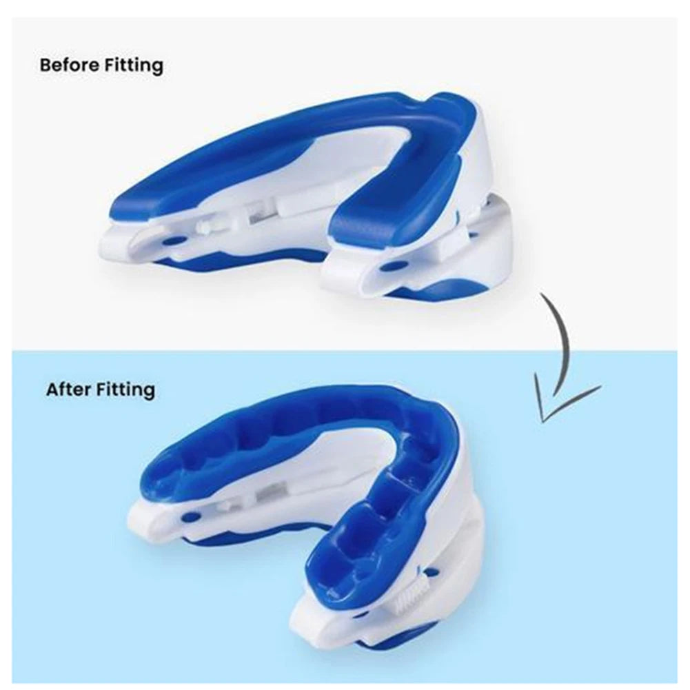 Anti-Snoring Mouthpiece